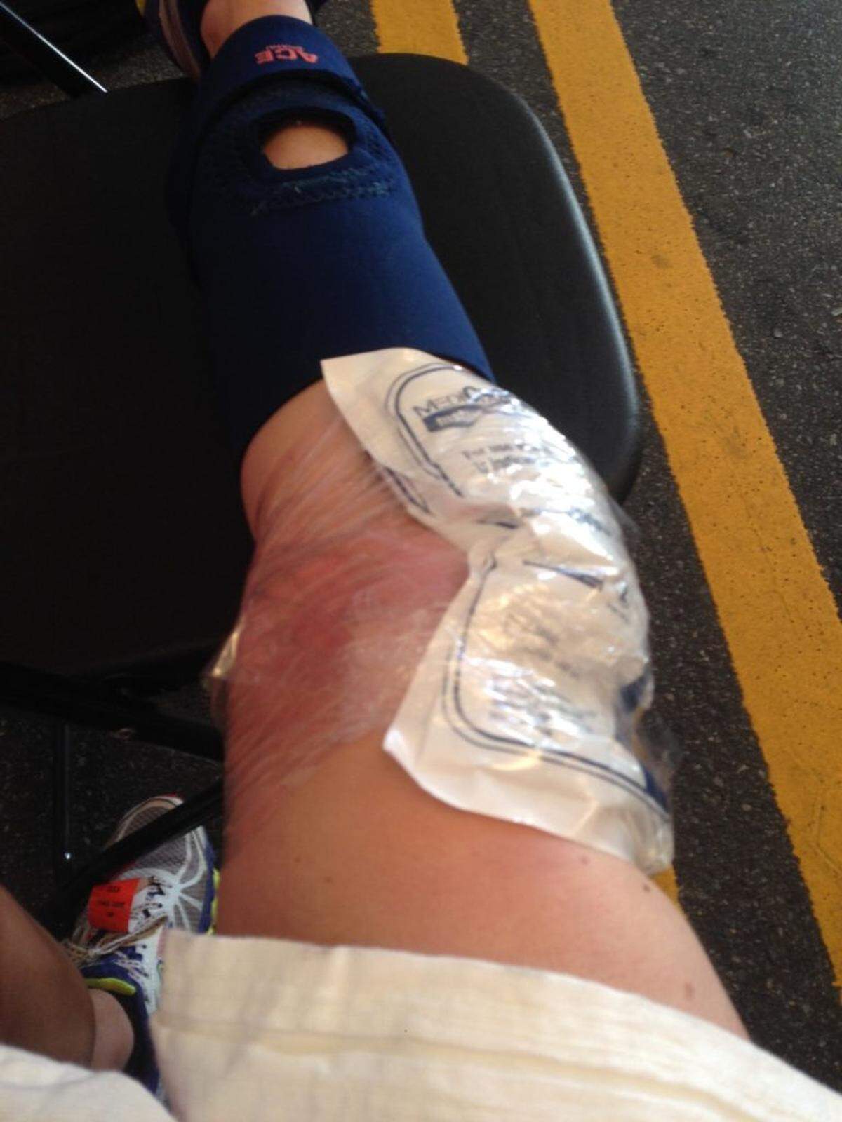 Icing my bad knee in the medical tent during the 2014 Thunder Road marathon. Photo by Liz Foster
