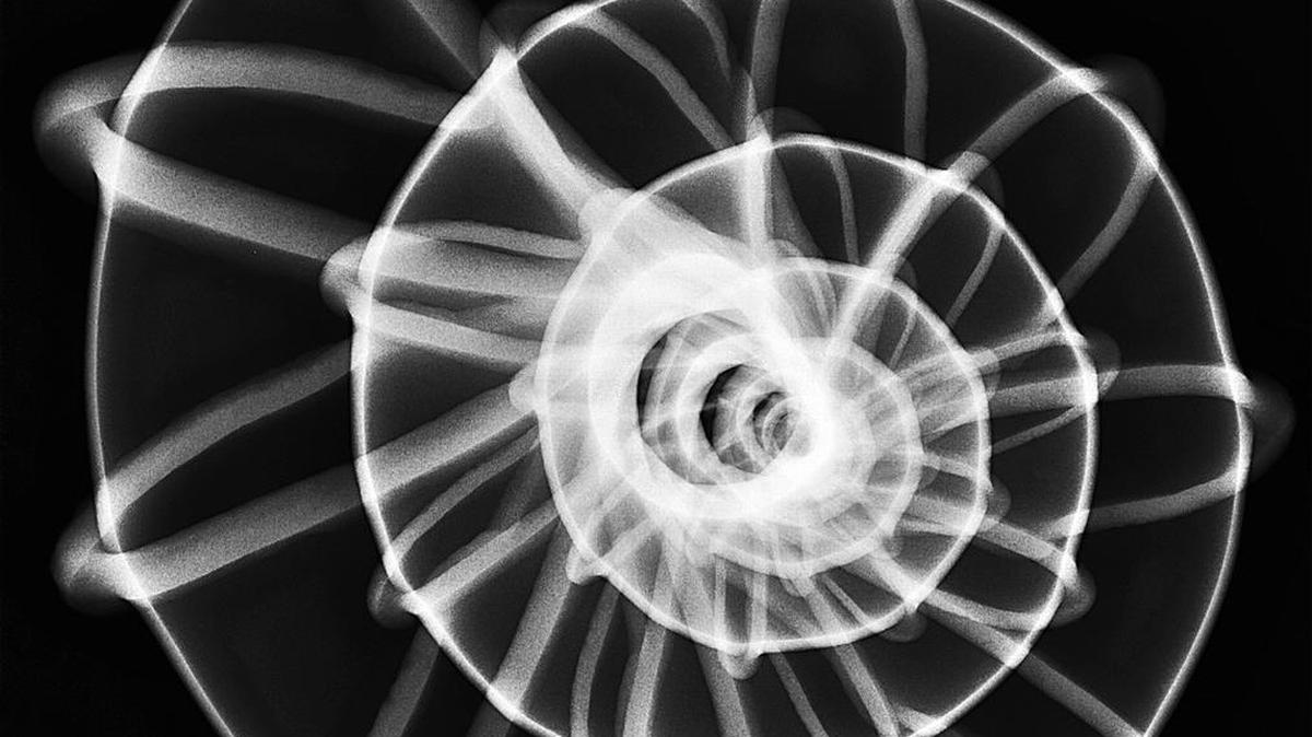 Elizabeth Turk’s “1 Wendel Trap” uses a X-ray and light box.