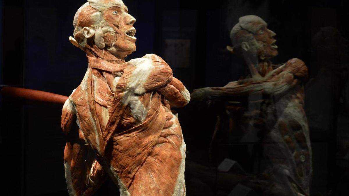 A display called "The Baseball Player", on display at the "Body Worlds & the Cycle of Life", exhibit that opens to the public November 21at Discovery Place in uptown Charlotte.