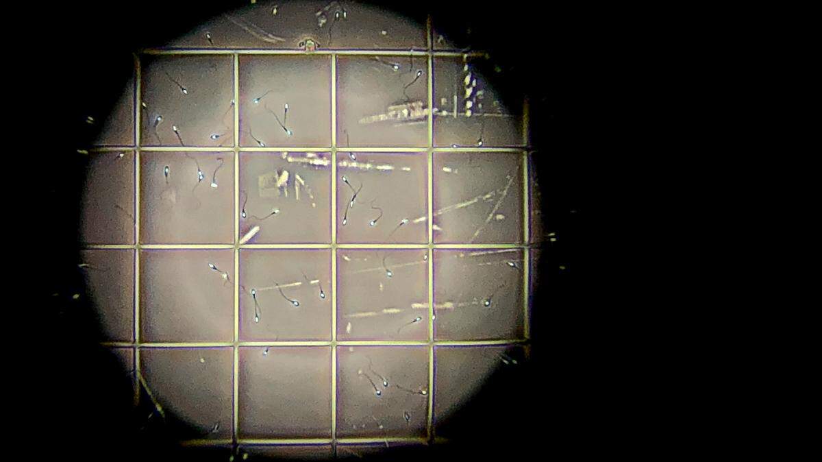 En esta foto del martes 15 de mayo de 2018, una muestra de esperma se ve a través de un microscopio en un laboratorio en Melbourne IVF en Melbourne, Australia. (AP Photo/Wong Maye-E)