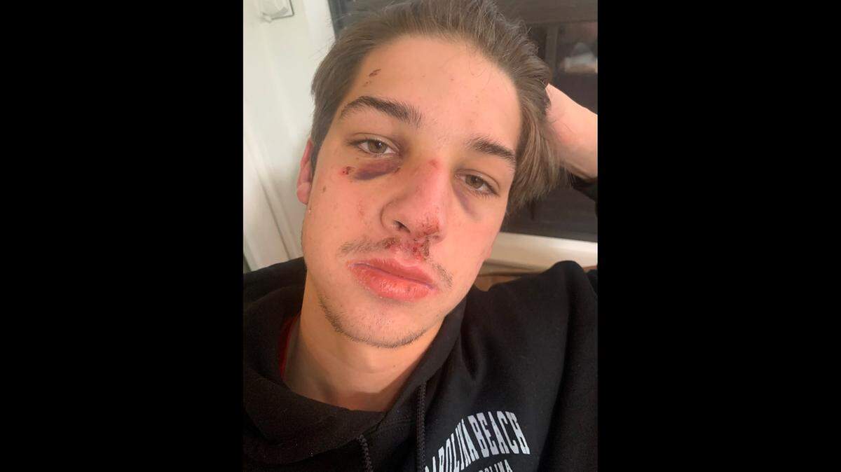 Jackson Cooper, a student at South Mecklenburg High School, told Charlotte-Mecklenburg police that a “group of players” from Myers Park High assaulted him after the Oct. 22 football game between the two schools. Cooper suffered a broken nose, his mother, Mindy Cooper, said.