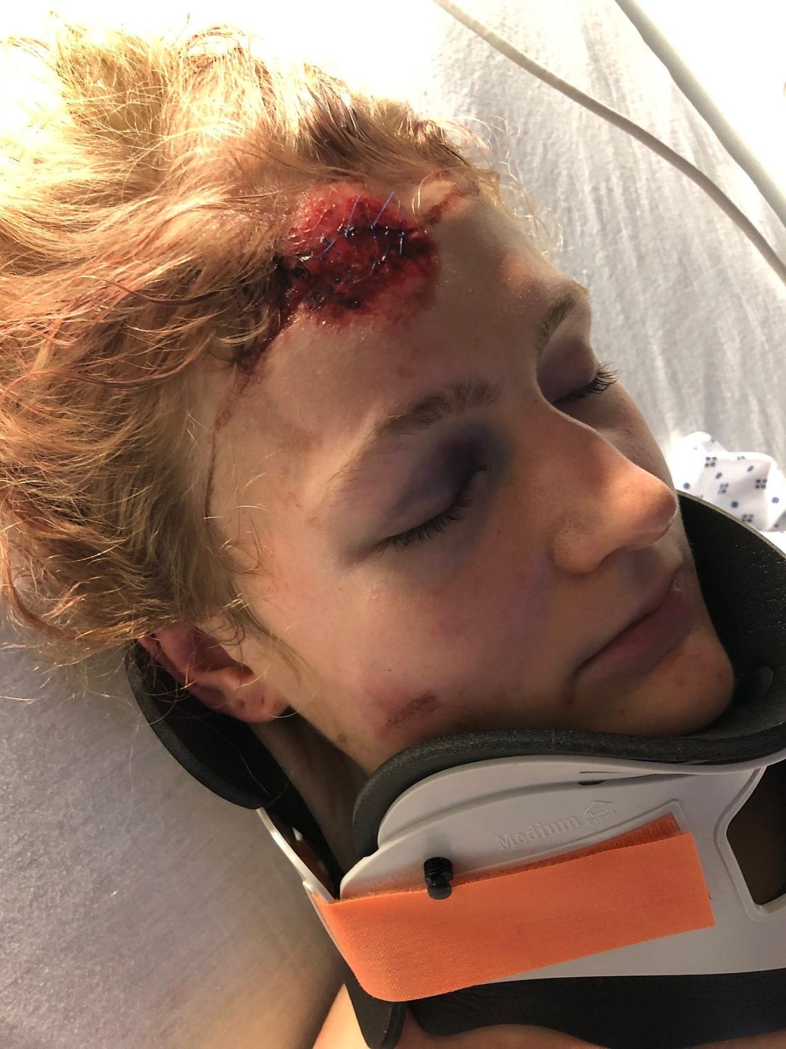 Sinclair Larson at the hospital after the accident.