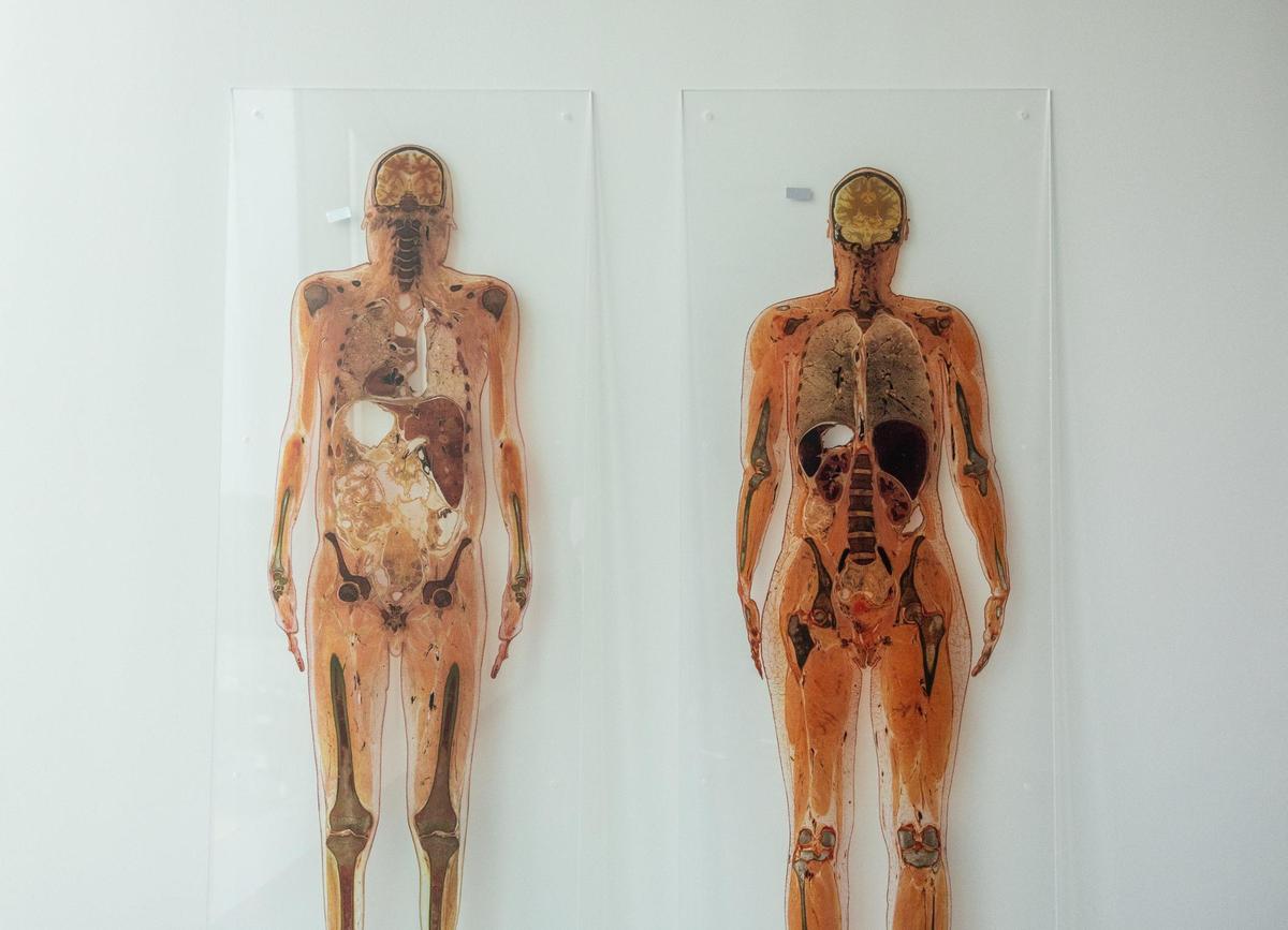 Anatomy cross sections on the wall in a classroom at Atrium Health Wake Forest University School of Medicine in Charlotte, N.C., on Wednesday, July 9, 2025.