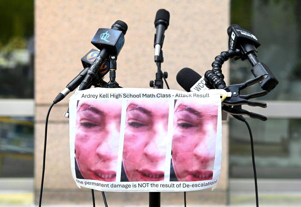 Images depicting injuries sustained by the 15-year-old female Ardrey Kell High student who was assaulted on March 7.