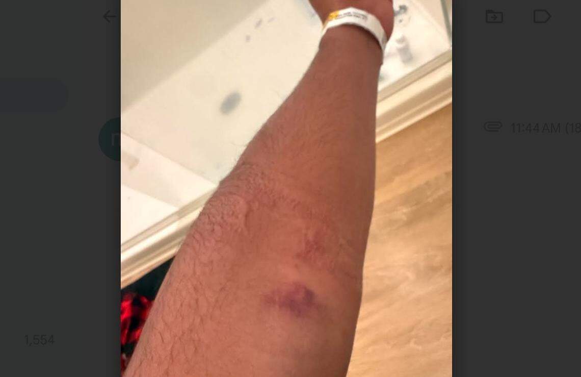 Cristobal Maltos said he suffered injuries when federal agents pulled him from his car and threw him onto the glass-strewn ashpalt on South Tryon Street in Charlotte on Monday, Nov. 17, 2025.