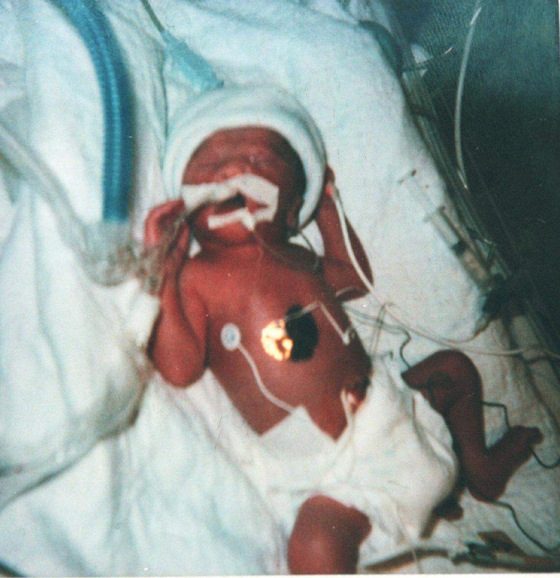 12/07/00 On Wednesday, Rae Carruth’s defense team introduced this photo of Chancellor Adams taken shortly after he was born on Nov. 16, 1999. Chancellor is the son of Carruth and Cherica Adams. Doctors delivered the baby by emergency Caesarean section after Cherica was shot four times. He was born several weeks early.