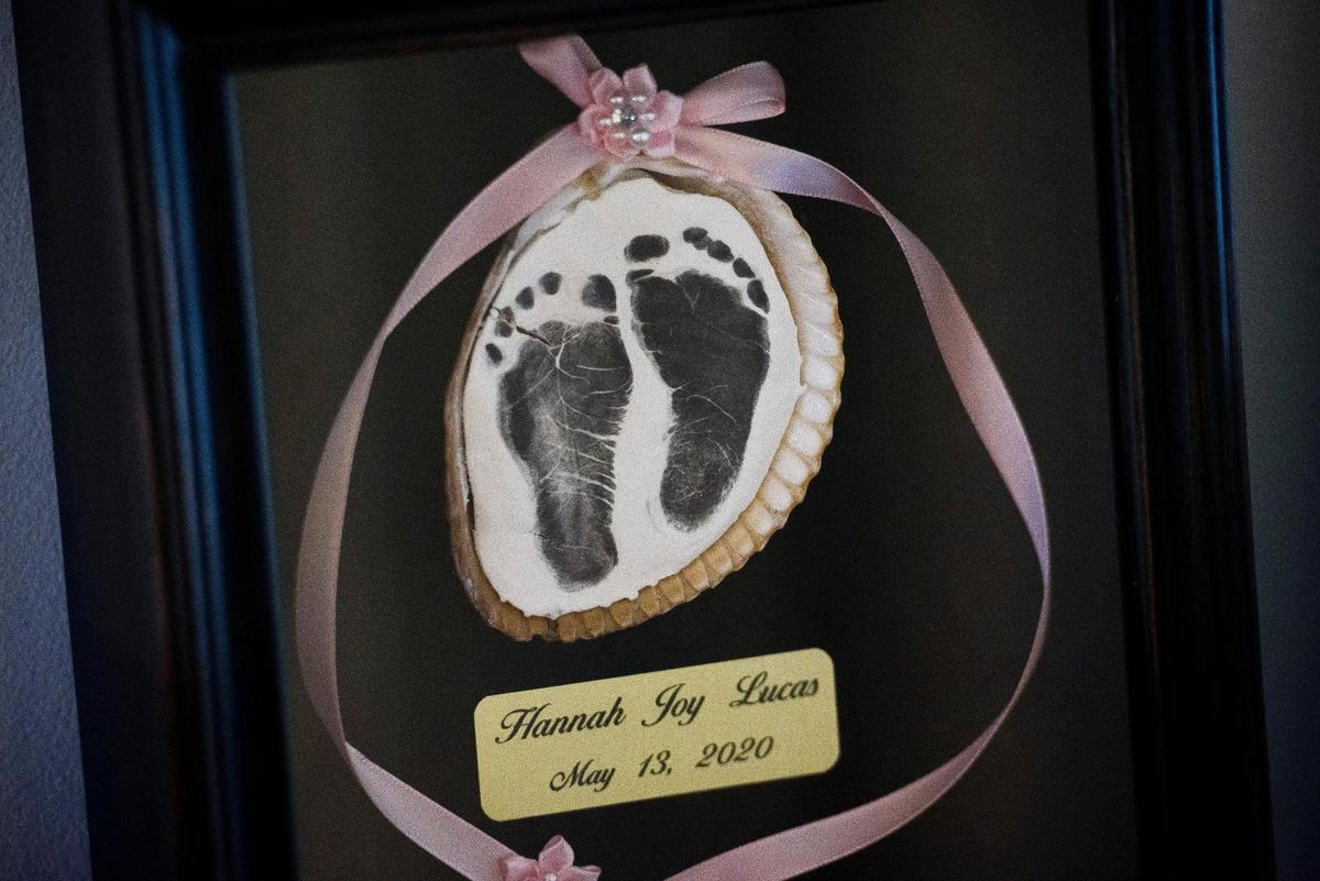 Footprints belonging to Hannah Lucas sit on display in the home of Allison Latos in Belmont. Hours after her birth, Hannah died from a rare condition.