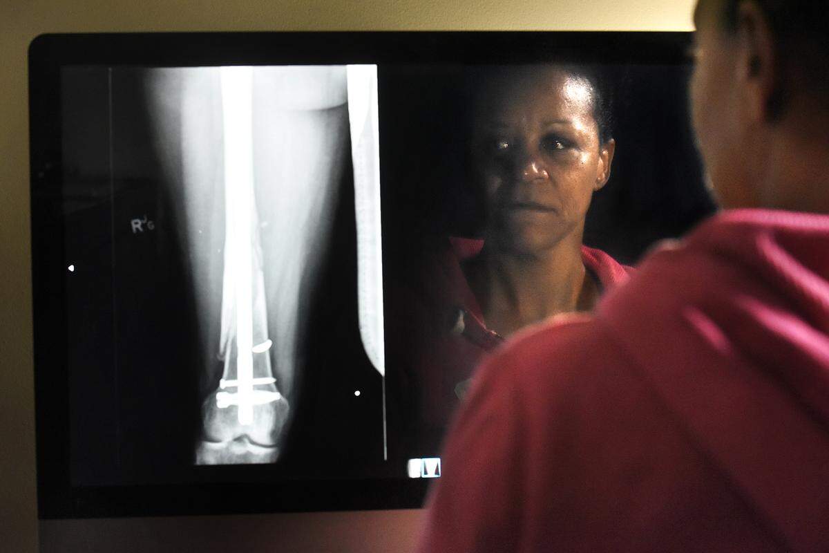 Ayanna Stinson says she feels constant and throbbing pain from wounds she got after she was shot eight times.