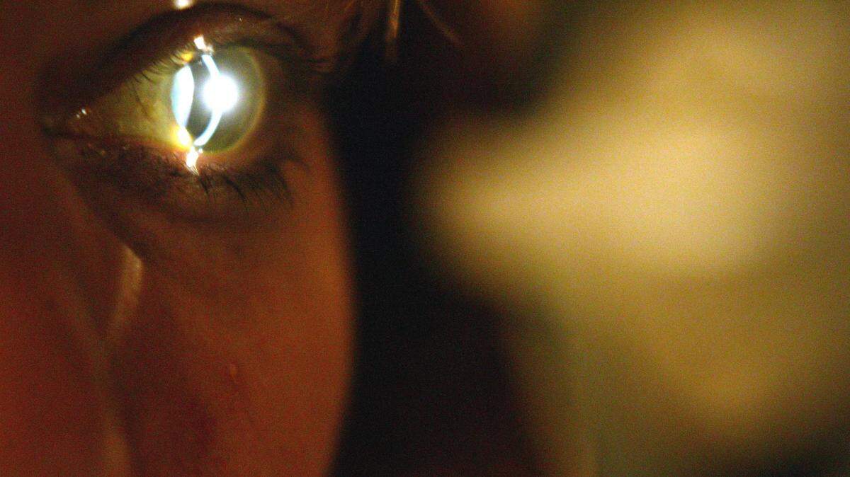 A year-long analysis of environmental clues to the unusual number of rare eye cancers in the Huntersville area has come up empty. But attention is turning to a similar rash of cases in Alabama.