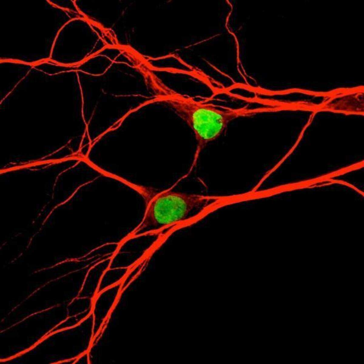 EdU could be used in the future to fight brain cancer because brain cells (pictured above) do not typically divide in adults