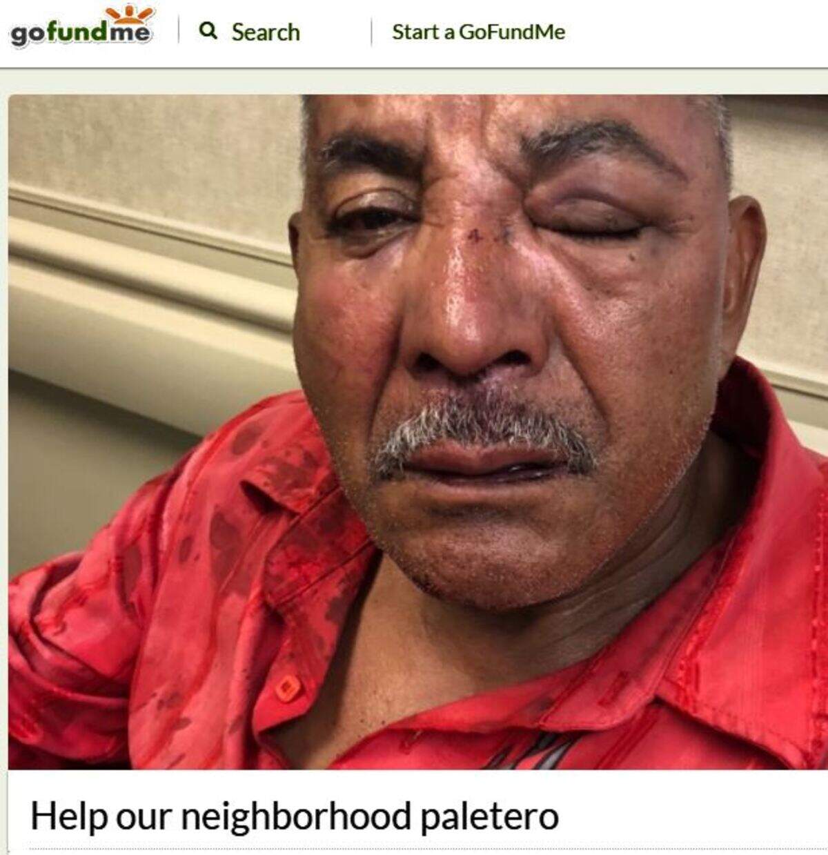 Toribio Alberto, who pushes an ice cream cart at apartment complexes off Nations Ford Road, was hospitalized after being robbed and beaten on Tuesday night.