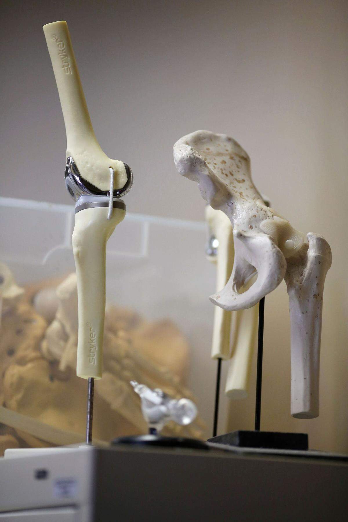 Bone and joint models are displayed at Central Carolina Orthopaedic Associates in Sanford.