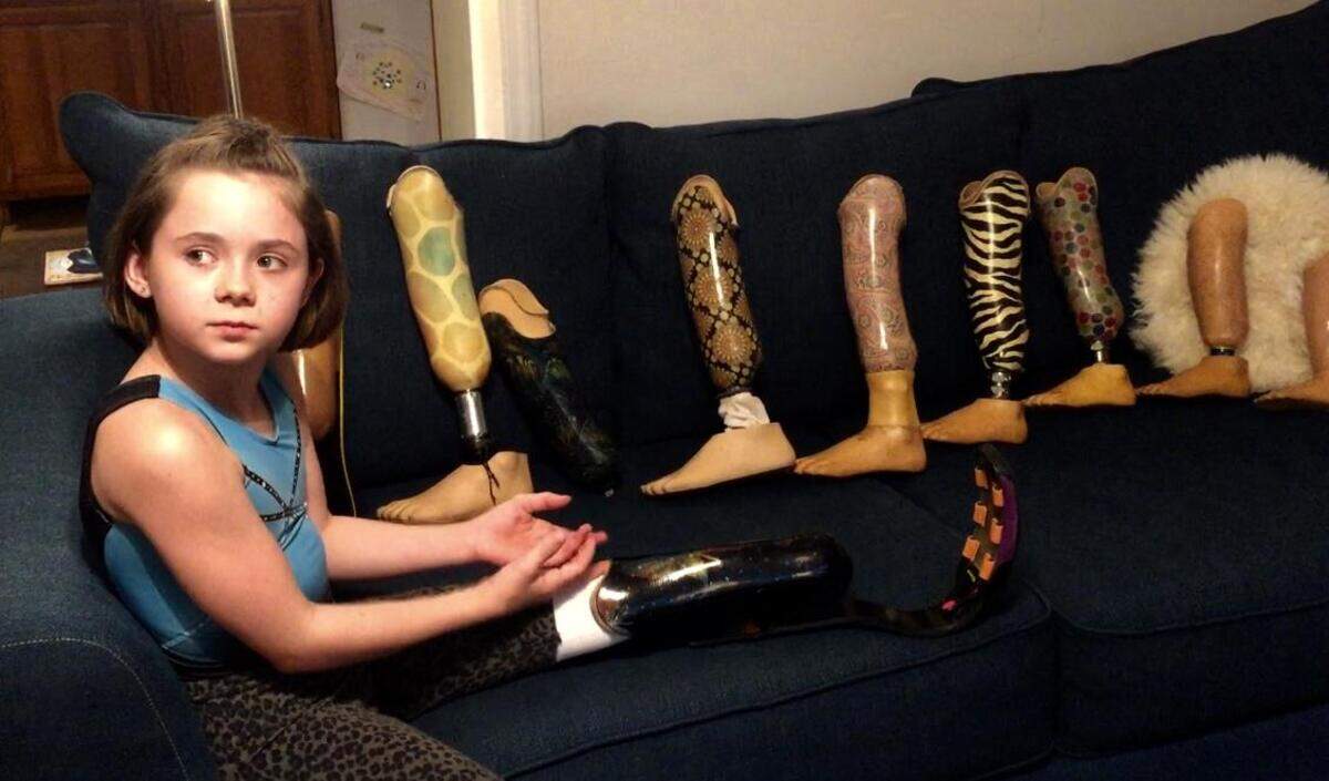 At her family’s home outside of Asheville, 10-year-old Zoe Smith explains the array of prosthetic left legs she has used through the years. She calls the one she uses for gymnastics competitions her “cheetah foot.”