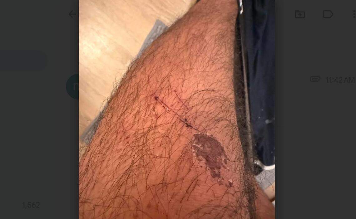 Cristobal Maltos said he suffered injuries when federal agents pulled him from his car and threw him onto the glass-strewn ashpalt on South Tryon Street in Charlotte on Monday, Nov. 17, 2025.