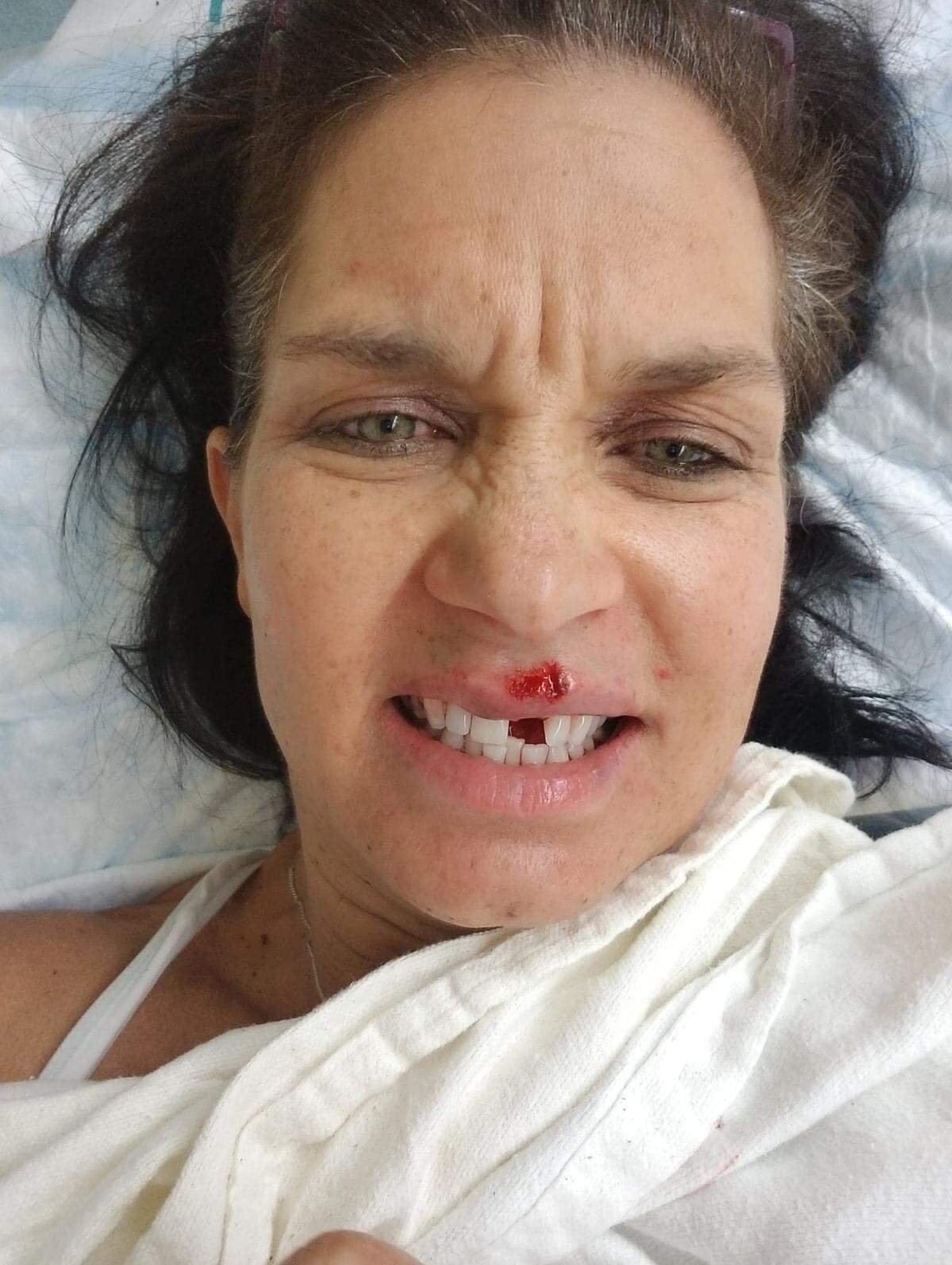 Christi Milledge took this selfie after being admitted to the emergency department.