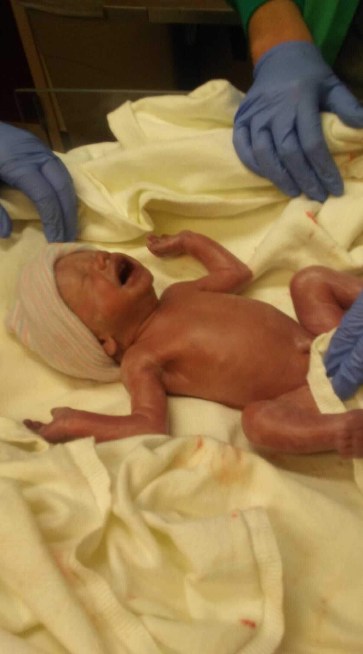 Minutes after Cypress is born, the baby is sent to the hospital’s Neonatal Intensive Care Unit.