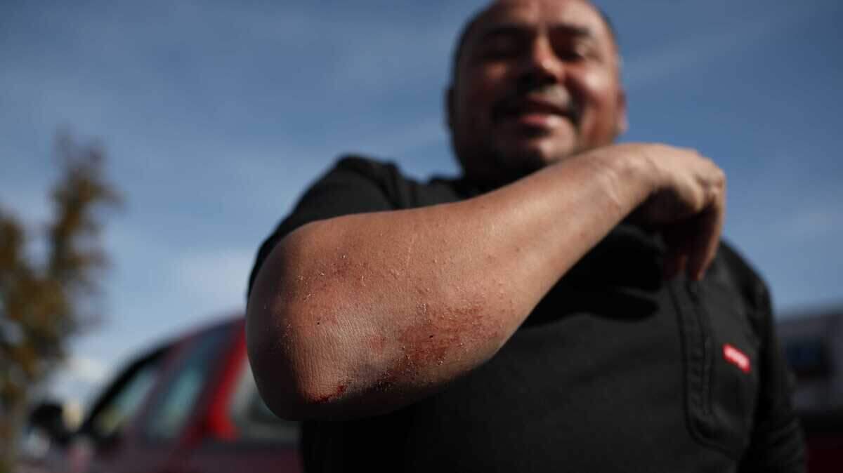 Willy Aceituno shows his scars from a confrontation with U.S. Border Patrol agents on Saturday morning at Pollo Campero restaurant near the intersection of South Boulevard and Archdale Drive. He said agents attempted to arrest him twice and smashed his car window when he tried to leave.