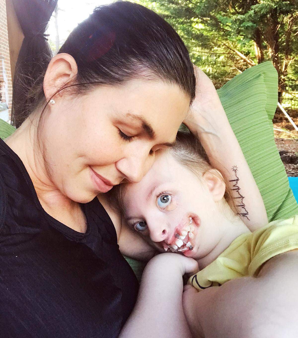 Natalie Weaver and her daughter Sophia cuddle in the backyard of the family’s Cornelius home. Sophia’s eyes couldn’t handle direct sunlight, so they built a covered porch behind their house for Sophia.