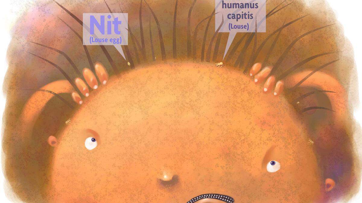 A Charlotte-based medical clinic specializing in the treatment of head lice is accused of unlawfully copying a patented device used to fight the pests.