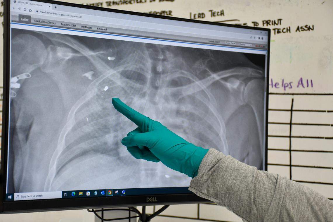 A staff member at the chief medical examiner’s office in Raleigh identifies a bullet on a decedent’s X-ray.