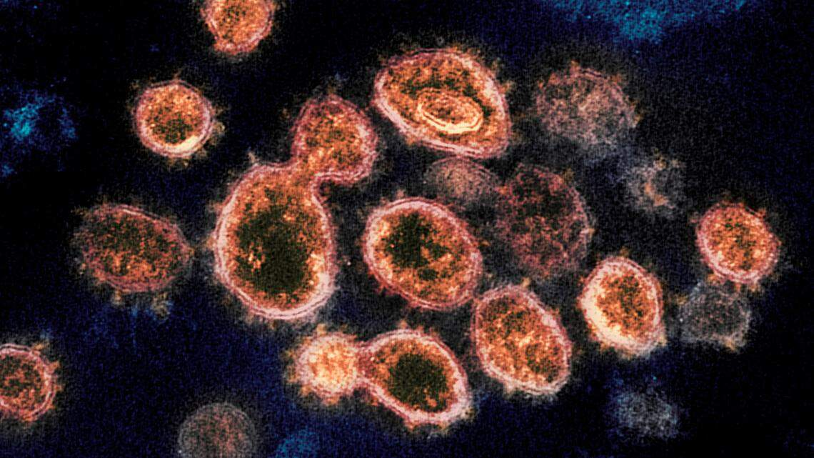 FILE - This 2020 electron microscope image provided by the National Institute of Allergy and Infectious Diseases - Rocky Mountain Laboratories shows SARS-CoV-2 virus particles which cause COVID-19, isolated from a patient in the U.S., emerging from the surface of cells cultured in a lab. Viruses are constantly mutating, with coronavirus variants circulating around the globe. (NIAID-RML via AP)