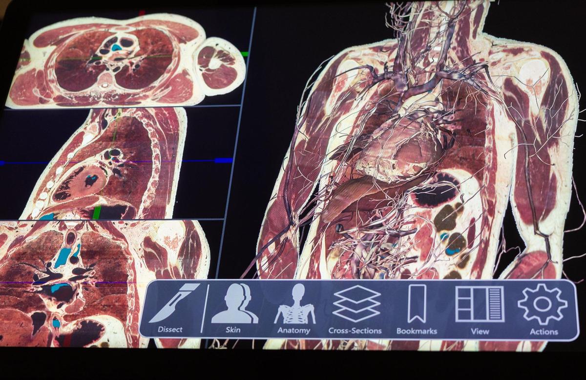 A Sectra Table that students will use to learn about the human anatomy at Atrium Health Wake Forest University School of Medicine in Charlotte, N.C., on Wednesday, July 9, 2025.