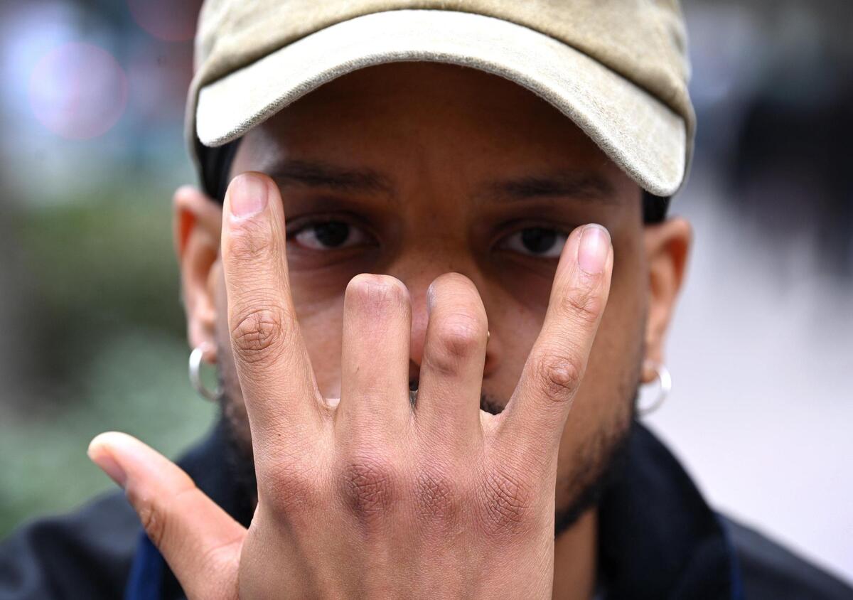 Kyre Mitchell says he lost parts of his right hand on the night of May 30, 2020, during a confrontation between protesters and CMPD.