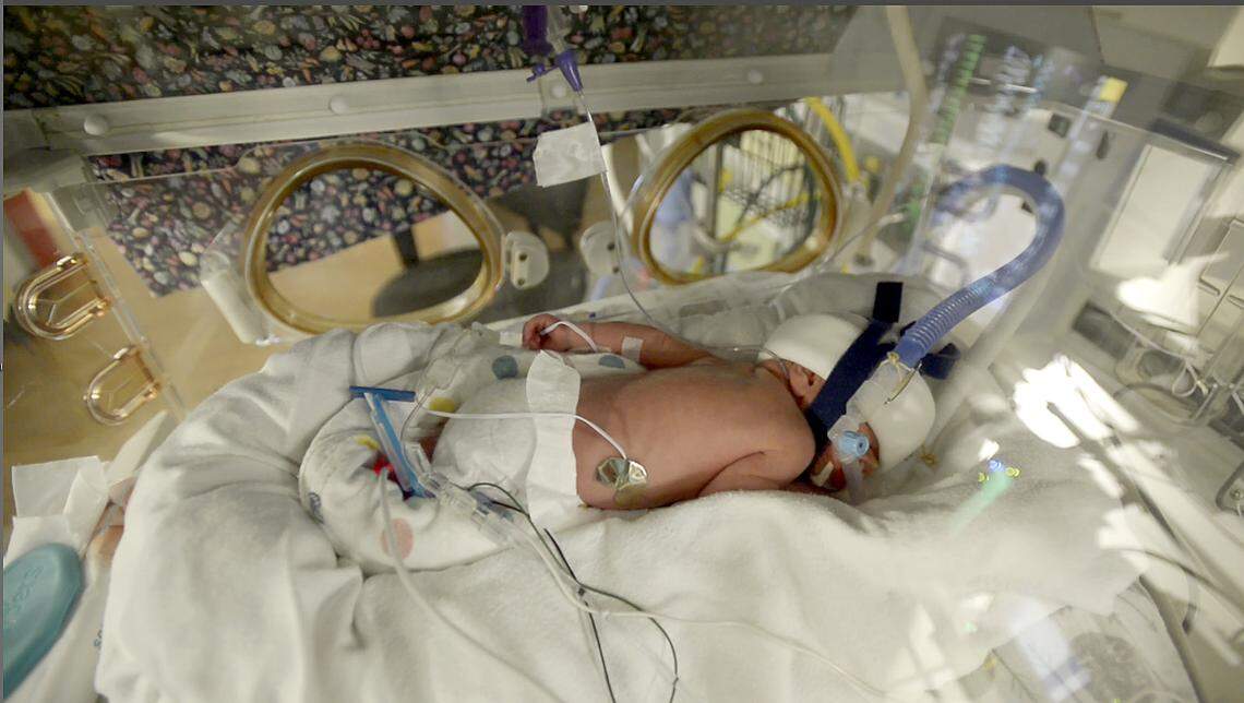 Cypress in the intensive care nursery at Levine Children’s Hospital.