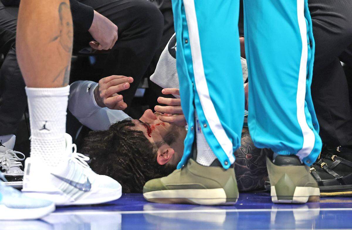 Blood flows from above Charlotte Hornets guard LaMelo Ball’s right eye after being involved in a collision with head coach Charles Lee during action against the New Orleans Pelicans at Spectrum Center in Charlotte, NC on Monday, Feb. 2, 2026.