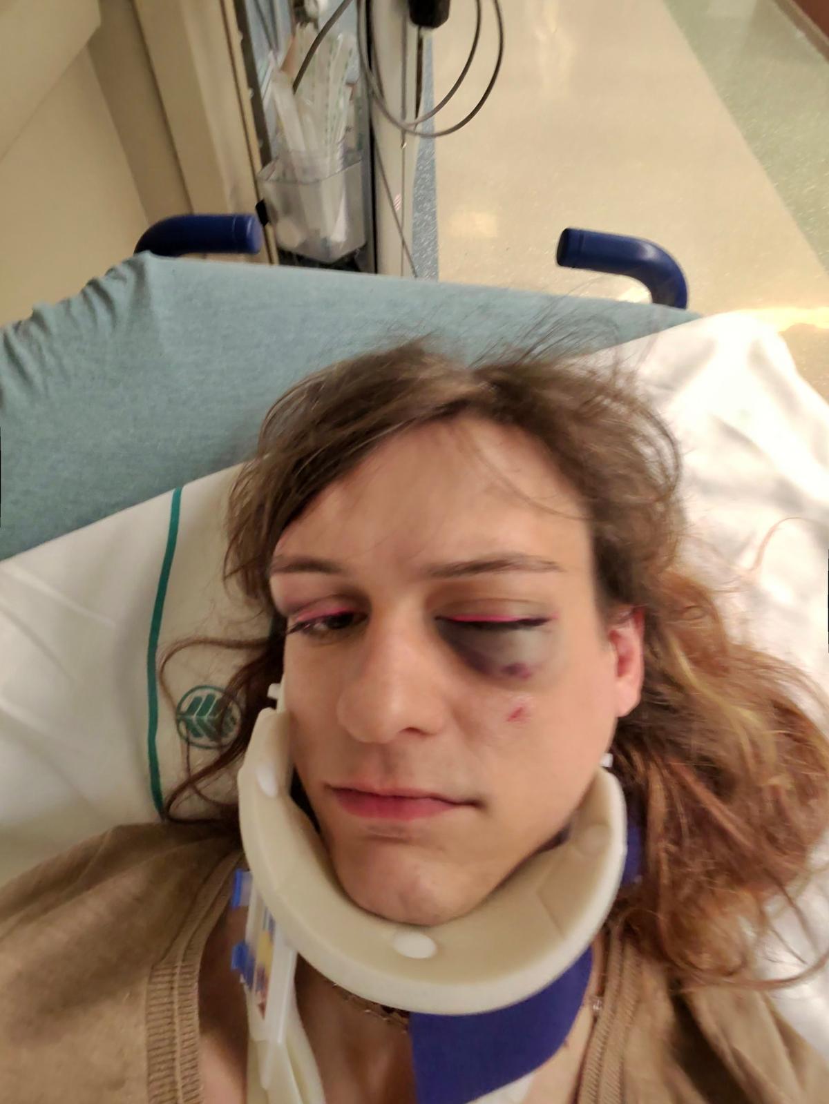 Lynette Matusik after her run-in with a bouncer who was working at a NoDa pub.