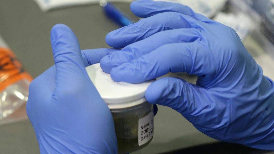 A Florida Department of Health employee processes a urine sample to test for the Zika virus, Wednesday, Sept. 14, 2016, in Miami Beach, Fla. The department is offering free Zika testing for two days to those who live or work in the area of Zika transmission in South Beach.