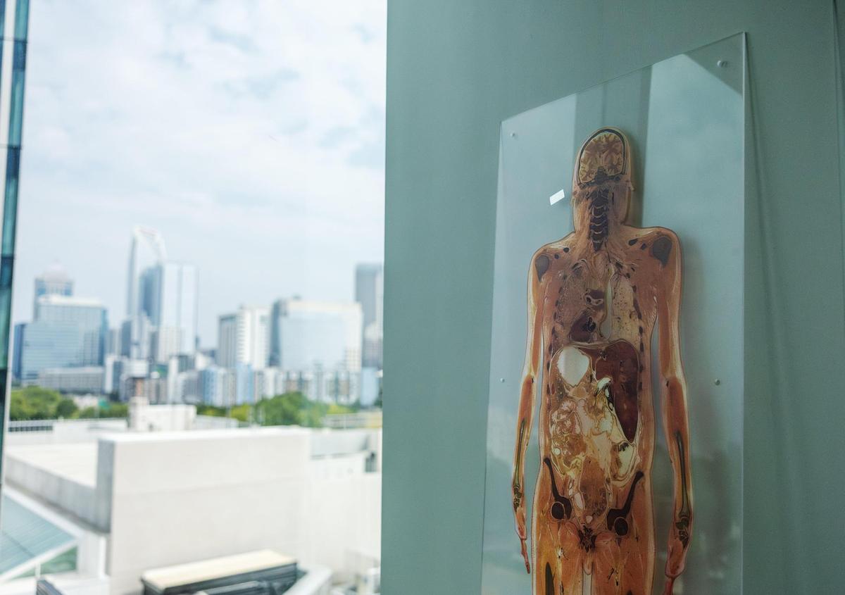 An anatomy cross section on the wall in a classroom at Atrium Health Wake Forest University School of Medicine in Charlotte, N.C., on Wednesday, July 9, 2025.