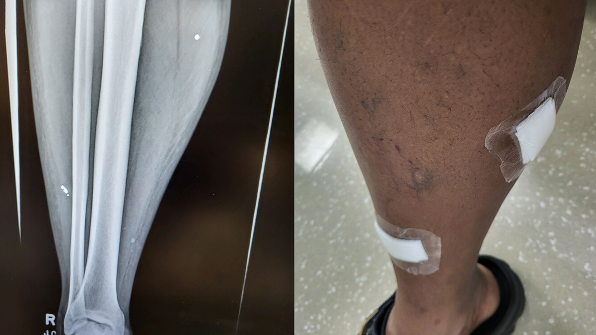 Cedric Rush, 57, left Cracker Barrel with shrapnel in his legs after a stray bullet fired in the restaurant on April 24 at about 6 p.m. according to Rush and a Charlotte-Mecklenburg Police report.