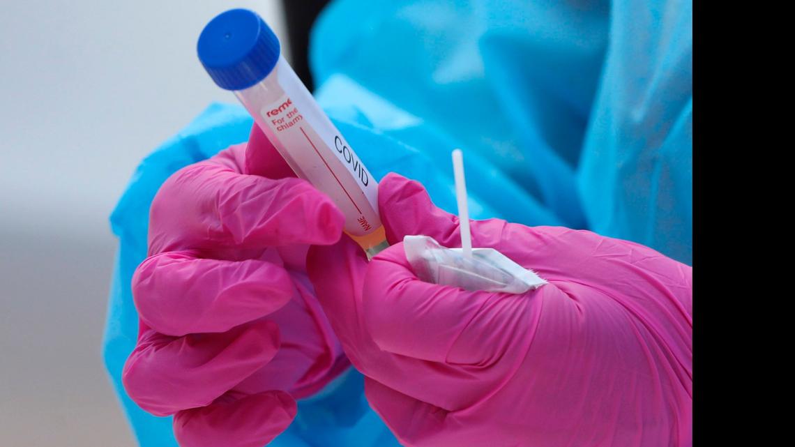 A COVID-19 test is prepared at a mobile pop-up testing June 15 in Raleigh. Advance Community Health set up the site at Abundant Life Cathedral. Testing was free and results returned within 48 hours. 