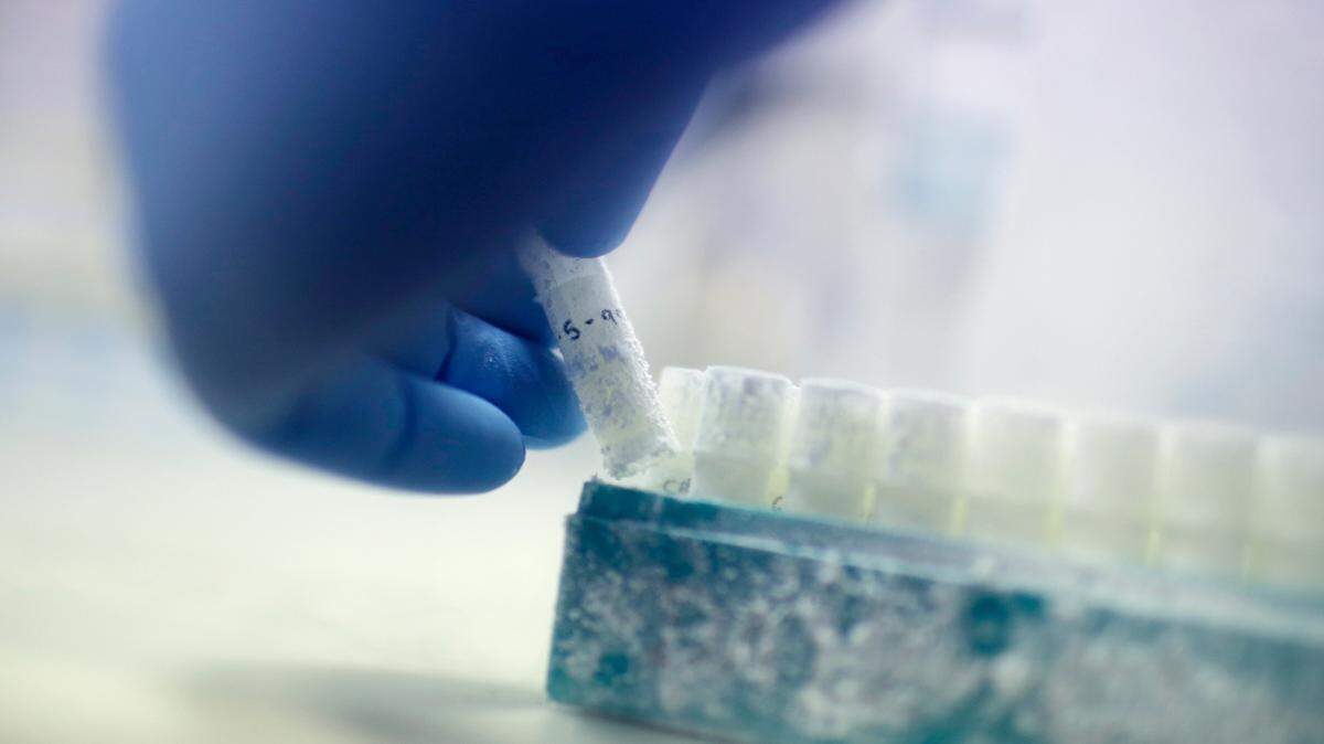 Scientist Fabrice De Bond picks up a vial containing frozen donor sperm samples in a lab at Melbourne IVF in Melbourne, Australia, AP file photo, 2018. (AP Photo/Wong Maye-E)