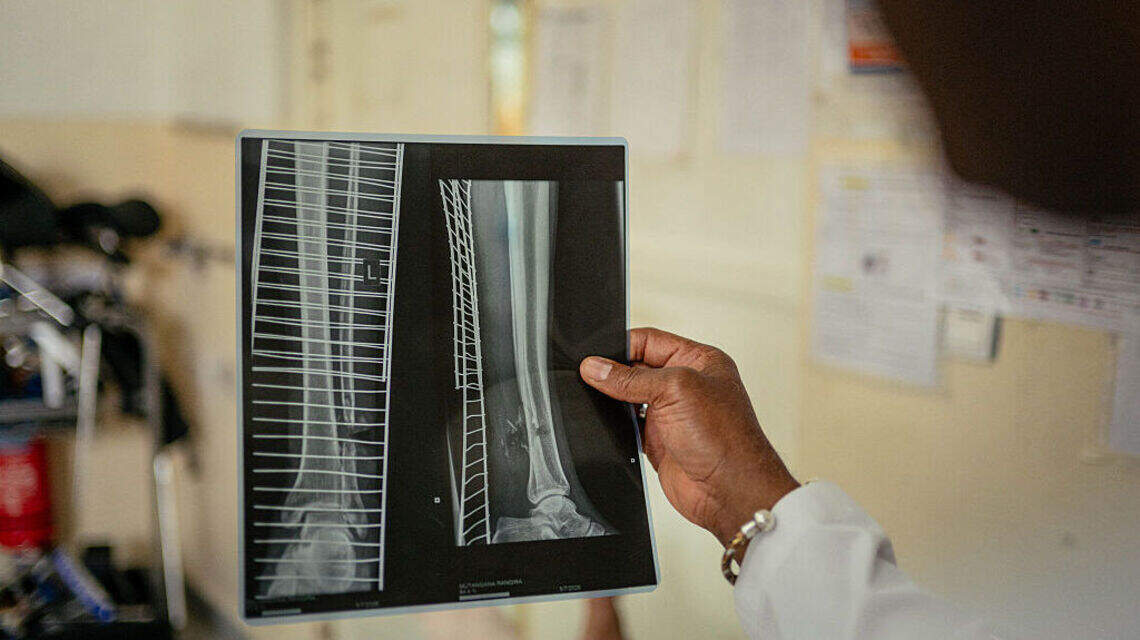 No, Bone Loss After 50 Is Not Inevitable and You Can Minimize Risk Using Daily Science-Backed Habits
