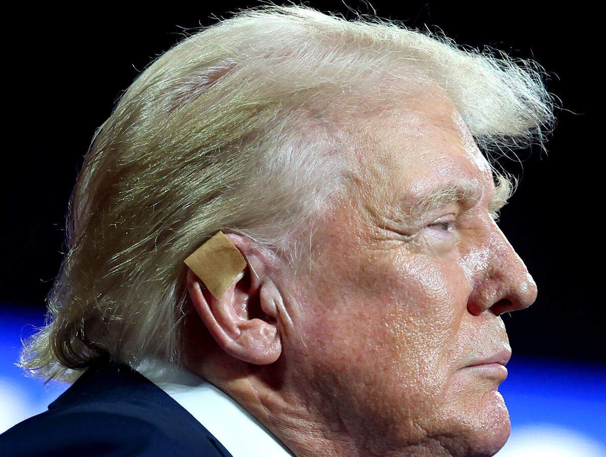 Former President Donald Trump’s right ear still has a small bandage covering the wound he sustained during an assassination attempt in Butler, PA. The Former President Trump spoke at a rally at Bojangles Coliseum in Charlotte, NC on Wednesday, July 24, 2024.