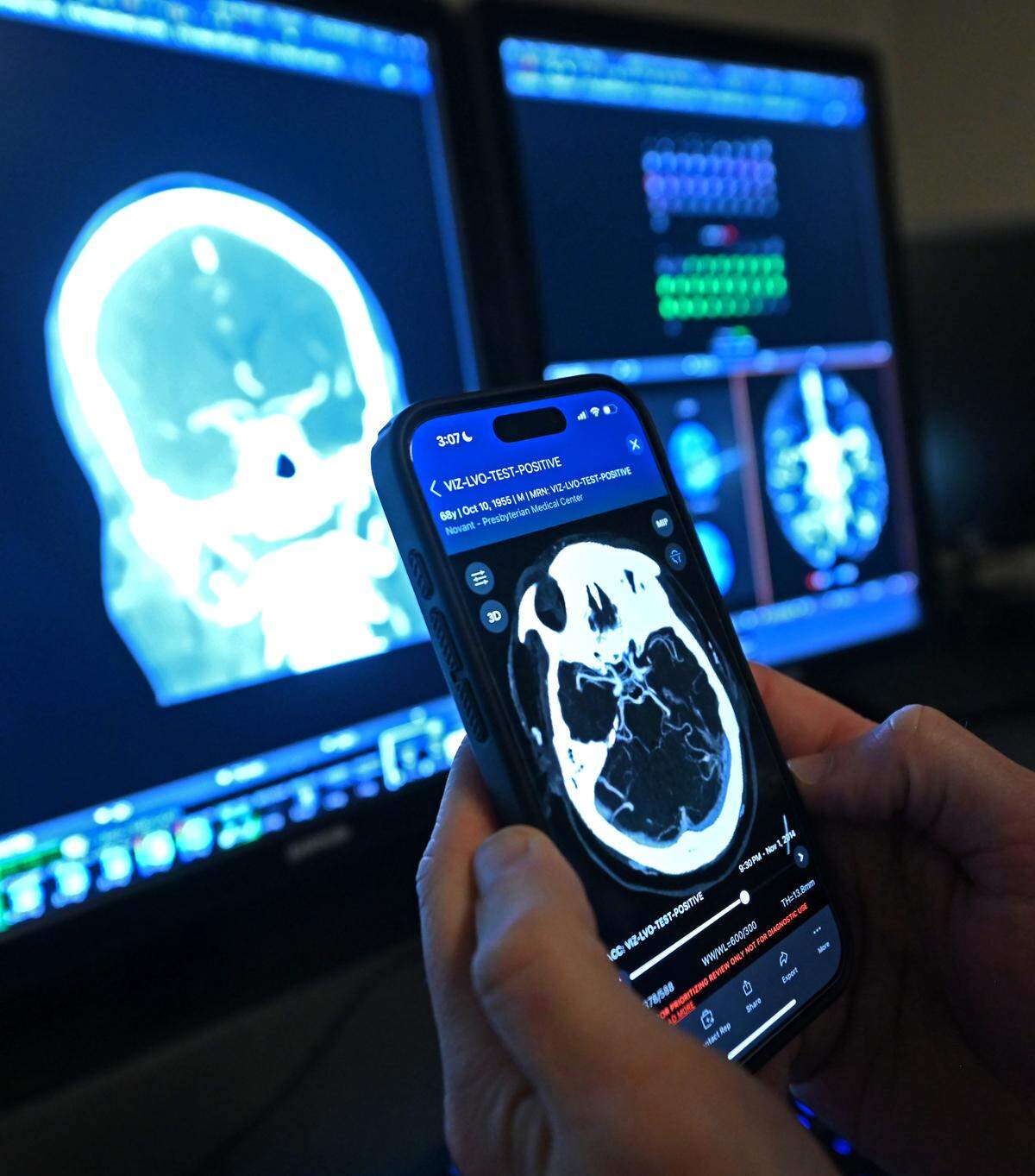 Dr. Andrew Griffin II, MD, a neuro-interventional radiologist at Novant Health Presbyterian Medical Center in Charlotte, NC received a call concerning a 93-year old who had possibly had a stroke on May 10, 2023. Griffin was able to use an AI app on his phone to analyze the patients brain scans. Using the AI technology, Griffin was able to see that the patients condition was serious but he could still save their brain if he could get to the clot in time.