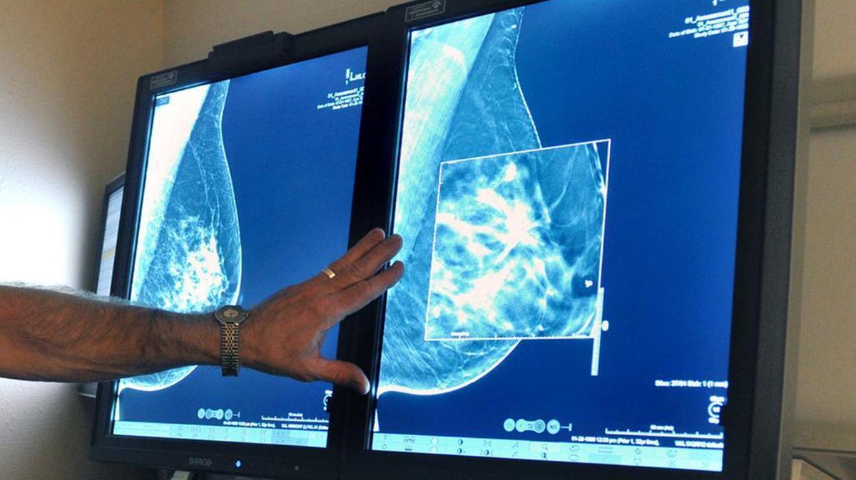 In guidelines published Tuesday, Oct. 20, 2015, the American Cancer Society revised its advice on who should get mammograms and when, recommending annual screenings for women at age 45 instead of 40 and switching to every other year at age 55. The advice is for women at average risk for breast cancer. Doctors generally recommend more intensive screening for higher-risk women.