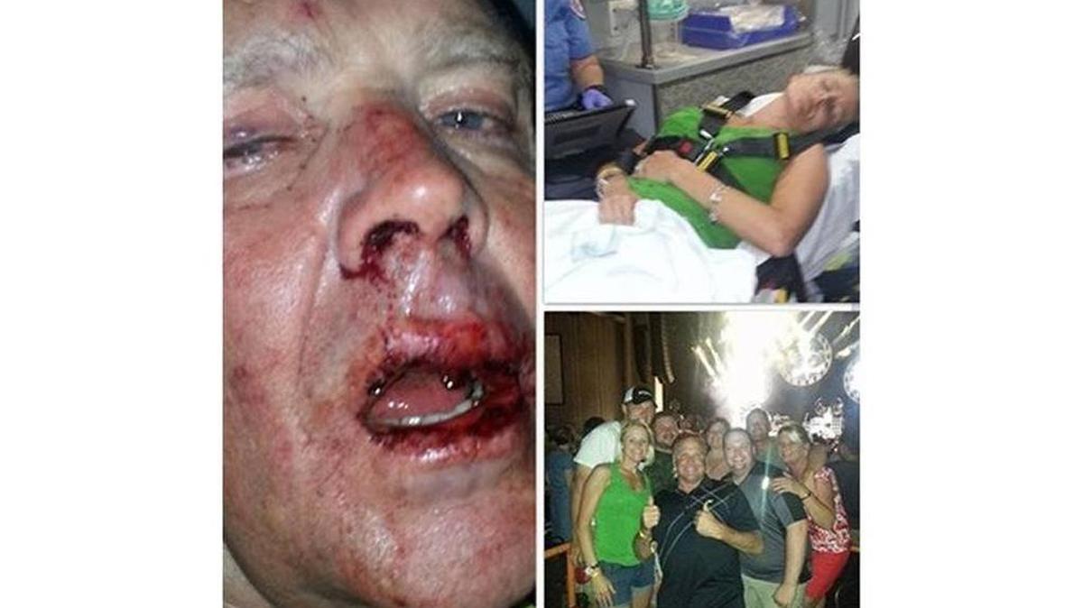 NASCAR driver Mike Wallace posted these pictures on Facebook of his bloodied face and of his daughter in a hospital bed after he said they were attacked Friday night in the parking lot of PNC Music Pavilion in Charlotte.