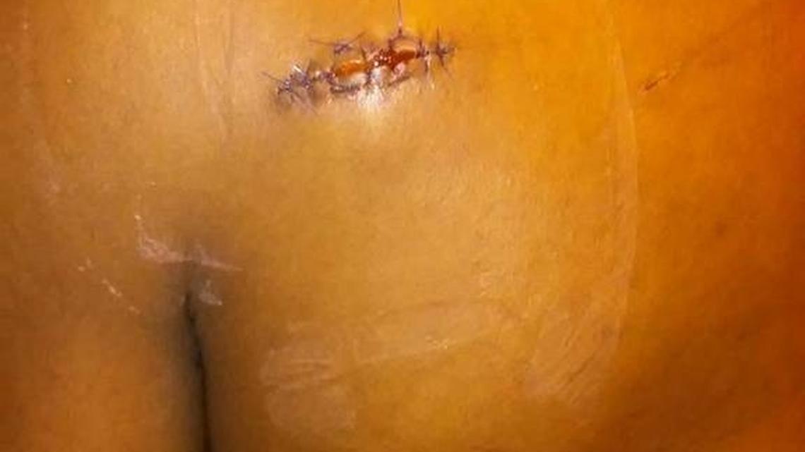 Ralayzia Taylor was assaulted with a hatchet last November in a Charlotte park. Three teens are charged. Taylor also is accused of sex crimes against a minor, an incident which may have set off the attack