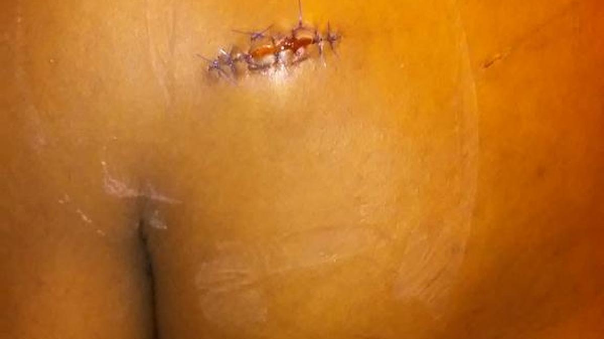 Ralayzia Taylor says her attackers struck her several times with an ax or hatchet during a Nov. 7 attack near Clanton Park