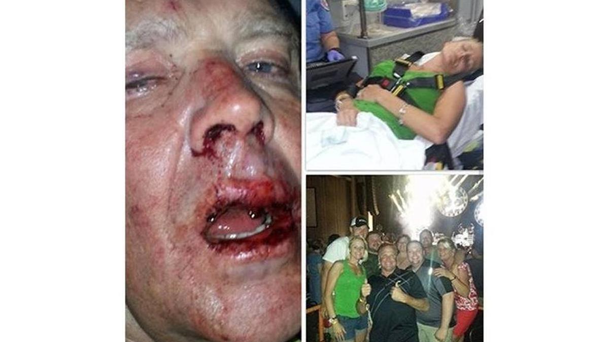 NASCAR driver Mike Wallace posted these pictures on Facebook of his bloodied face and of his daughter in a hospital bed after he said they were attacked Friday night in the parking lot of PNC Music Pavilion in Charlotte.