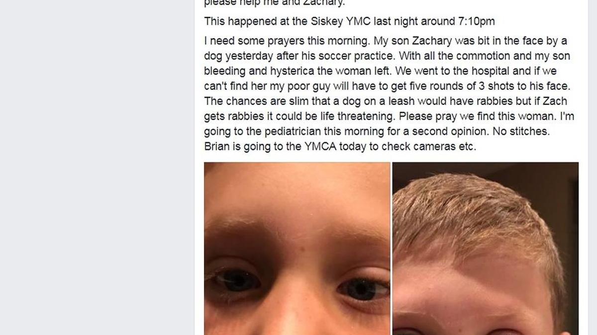 A Charlotte mom is looking for the owner of a dog that bit her son. If she’s unsuccessful, her son will need to get rabies shots.
