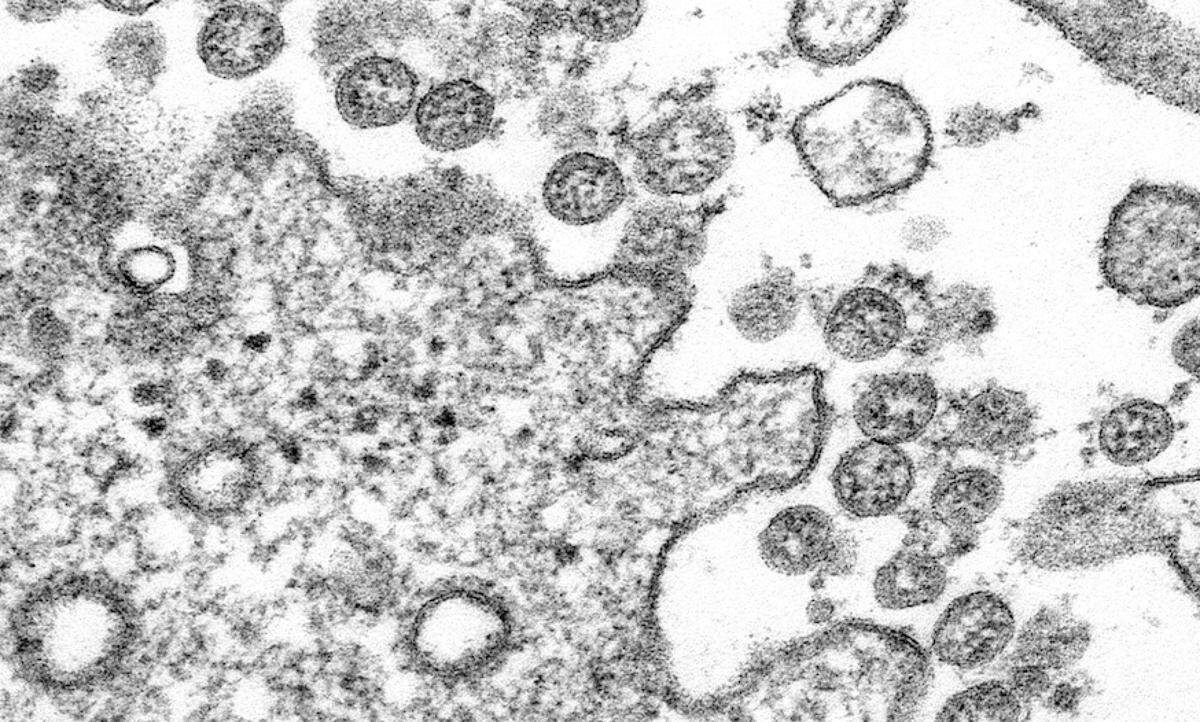 Transmission electron microscopic image of an isolate from the first U.S. case of COVID-19,