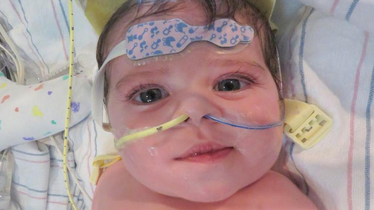 Naomi Reeves after her heart transplant.