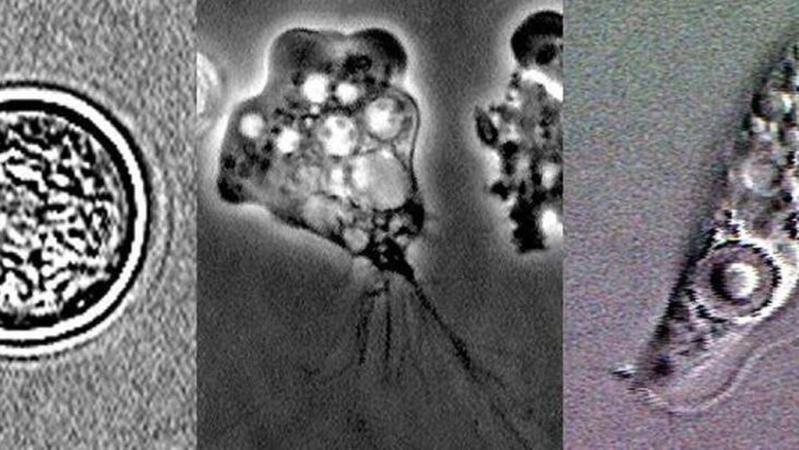 NC teenager infected with brain-eating amoeba has died. What we know