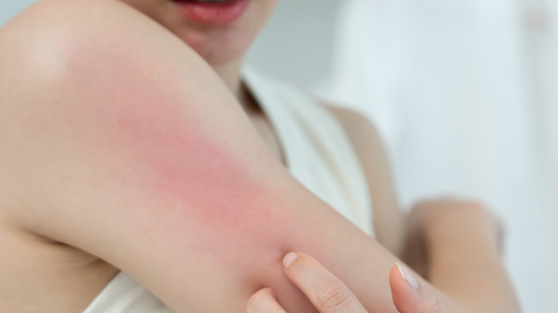 Sensitive Skin? Here’s What a Dermatologist Wants You to Know