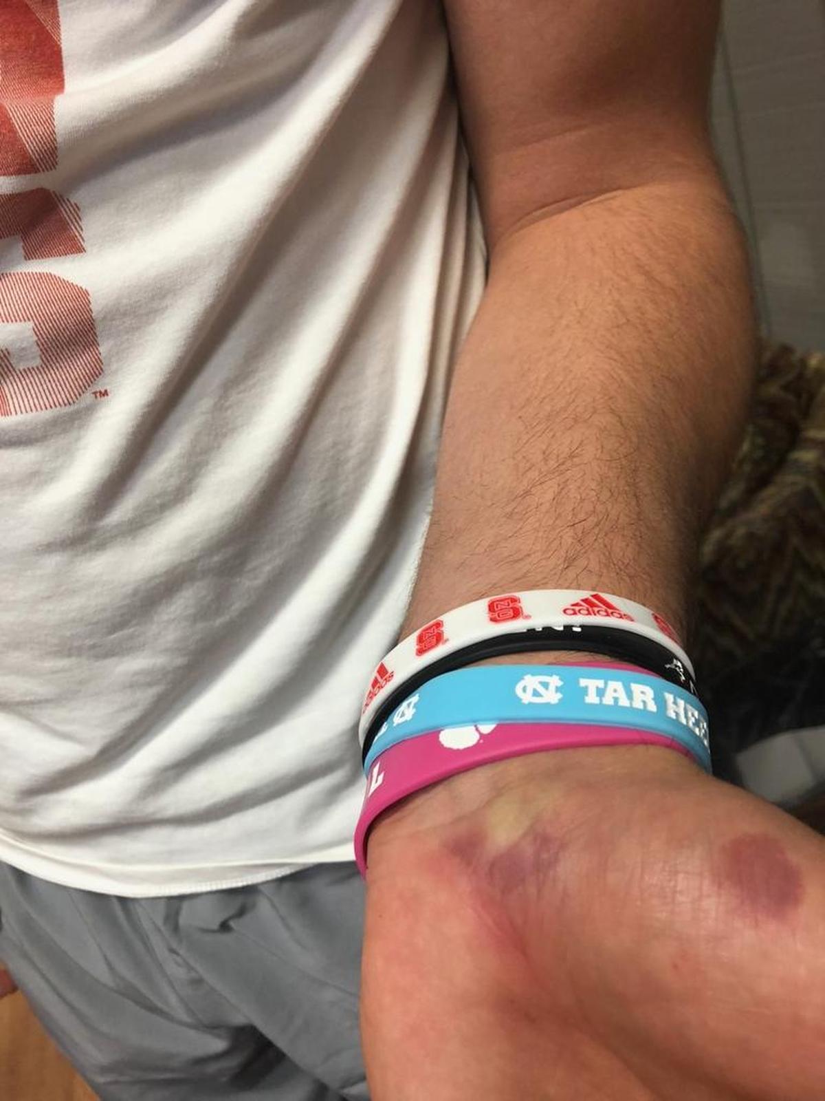Sun Valley quarterback Sam Howell split open his hand in a game against Porter Ridge last season. He finished the game but needed 13 stitches the next day. He has the scar to prove it.