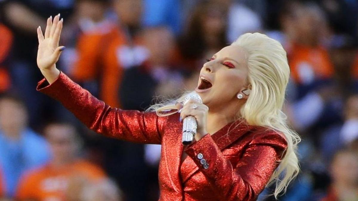 Among the things you can bet on for Sunday’s Super Bowl: Lady Gaga’s hair color.